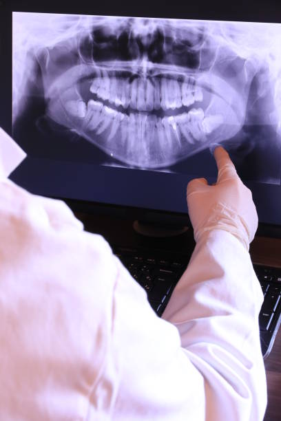 Best Emergency Dentist for Lost Fillings or Crowns in Jeffersontown, KY